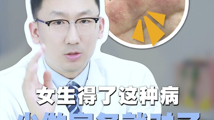 女生手上长这个，家务碰不得！但奇痒无比，医生三招教你轻松应对