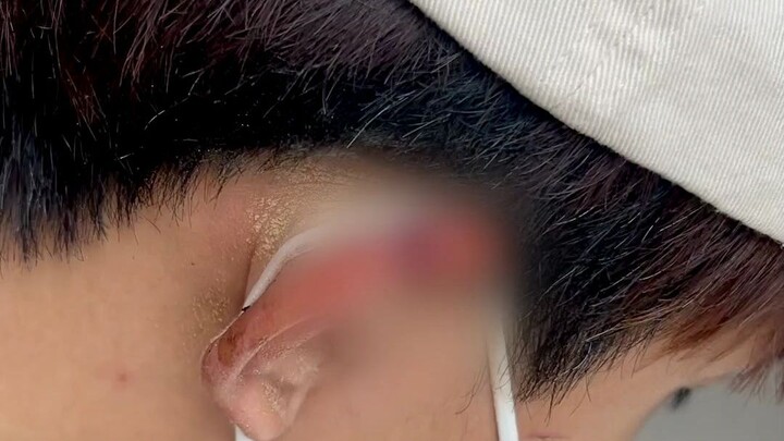 “Chuyện tôi đánh rớt tai anh ta”