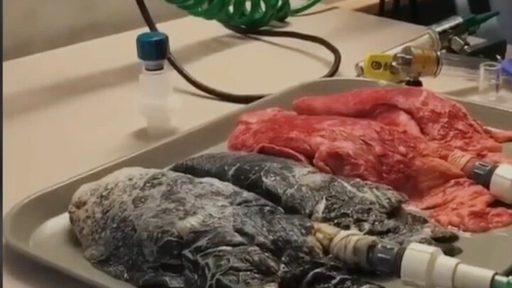 What's the difference between a normal lung and a smoker's lung after inflation?