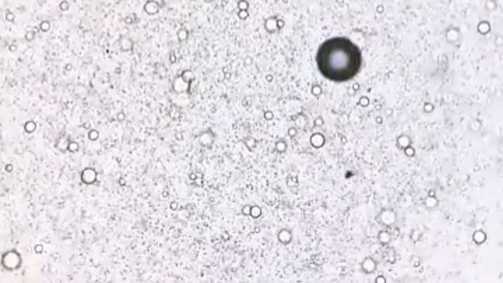 Don't use shampo until you watch this video under microscope you won't believe it under 400x zoom 🙀