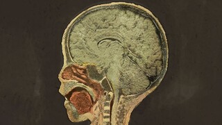 A Toddler Chewed Off Lead Paint on His Toys—Here's What Happened to His Brain