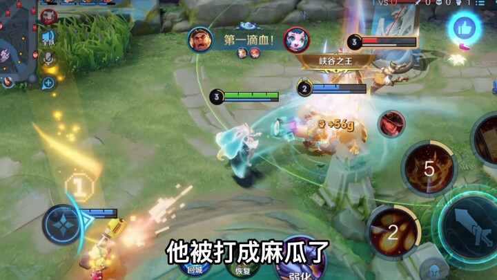 เล่นเมจต้องรู้จักการแก้ทางฮีโร่กันนะ 17! เลือกฮีโร่ให้เหมาะสมจึงจะช่วยทีมได้ดีขึ้น!