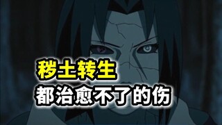 火影忍者：秽土转生都治愈不了的伤，长门的腿鼬的左眼，四代的伤才是最严重