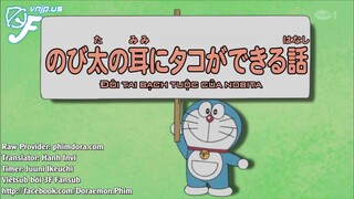 Doraemon : Cây lăn chuyển nhà - Đôi tai bạch tuộc của Nobita