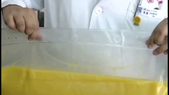 Two liters of oily fluid were dialyzed out of his blood—this man frankly said he was terrified just 