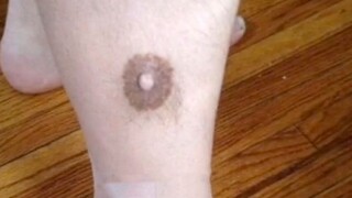 Why Does This Thing Grow On The Leg?
