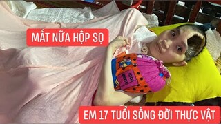 Đến thăm em gái 17 tuổi xinh đẹp như hoa bị tai nạn giao thông mất nữa hộp sọ sống như thực vật