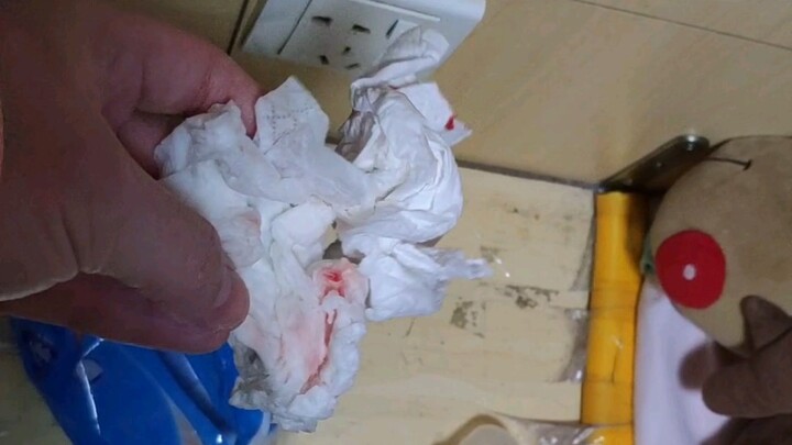 自闭症盲孩的父亲快崩溃了