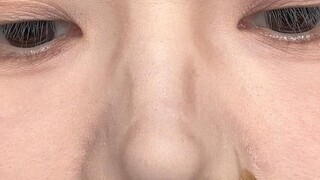 إذن هكذا يتم تعديل الأنف المسطح والأنف القرفصائي‼️