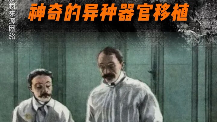 คนที่มีผิวหนังยาว!!!