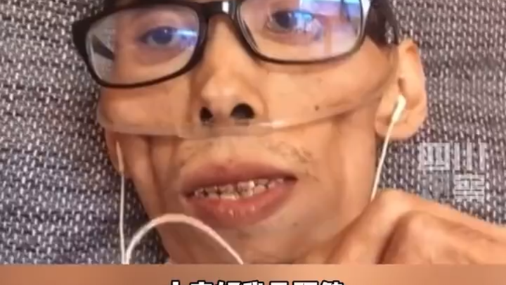 توفي أجيان، المدوّن المناهض للسرطان. شكرًا لتشجيعكم ومساعدتكم.