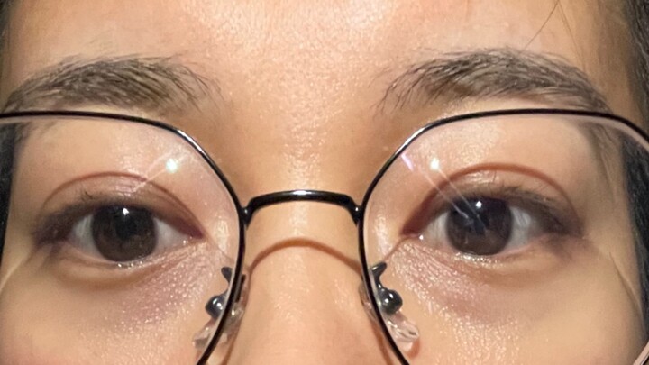 Tôi nói với bạn cùng phòng rằng tôi đã chi hơn 2000 để làm mí mắt kép