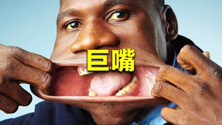 The person with the world's widest mouth—17 centimeters wide, able to fit a bottle of Coke