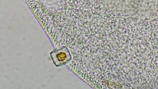 The Paramecium could not digest the diatoms and spit them out.