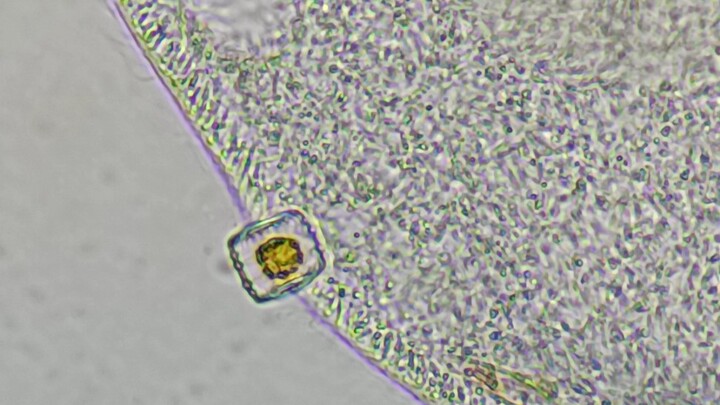 Paramecium tidak dapat mencerna diatom dan memuntahkannya.