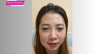 buat kenang kenangan ajaaaantara sedih tapi banyak ngakaknyako bisa sebengkak ini pipi sampe penyok