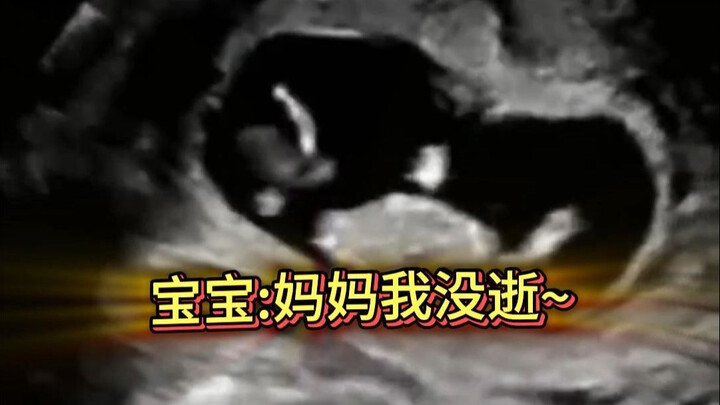 ลูกน้อย: แม่ หนูยังไม่ตายค่ะ