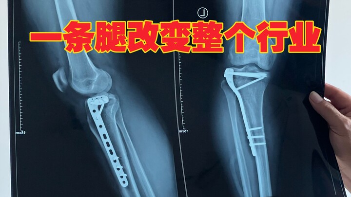 I’m absolutely sure you’ll back me as I expose these shoddy electric scooters causing deadly “death 