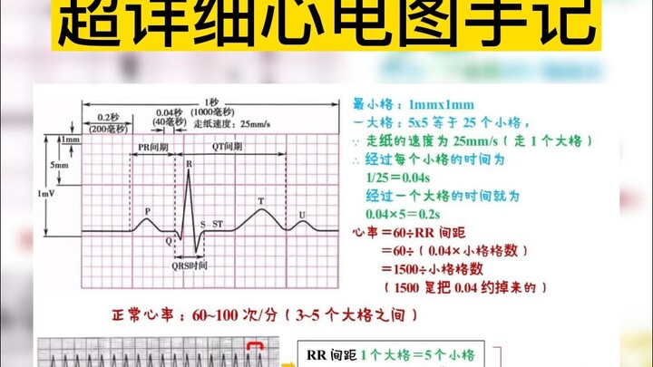 โน้ตคลื่นไฟฟ้าหัวใจฉบับละเอียดยิบ! ใครยังไม่เข้าใจมาที่ไลฟ์ของฉัน ฉันจะอธิบายให้ฟังเอง!