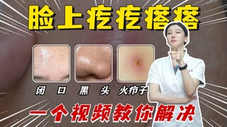 Can't tell the difference between the pimples on your face? This video will teach you how to fix it!