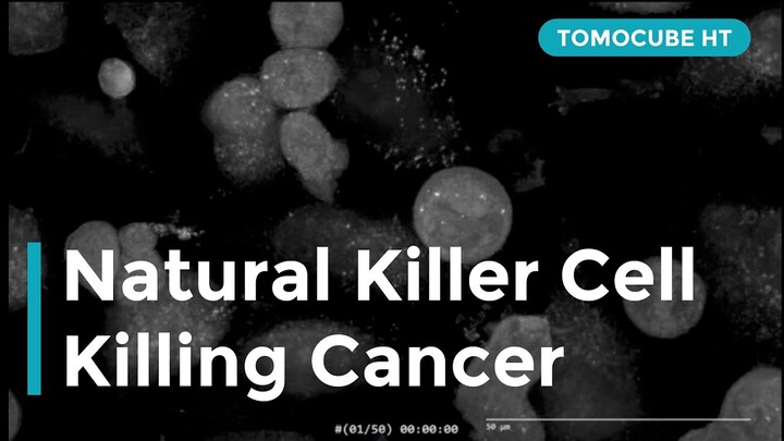 Natural Killer Cell Killing Cancer