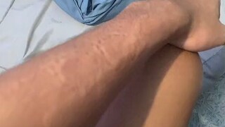 bite marks