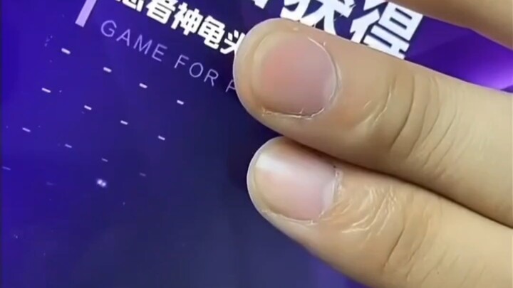 Lebih menegangkan daripada pengecekan nilai ujian masuk perguruan tinggi