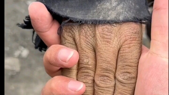 A Pair of 12-Year-Old Children's Hands