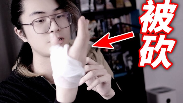 My relative chopped my right hand! And all I can do is reconcile?