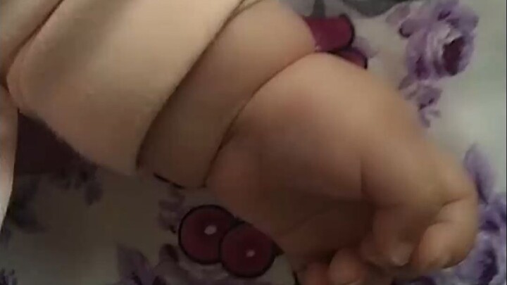 You never know what's hiding in the folds of your baby's wrists!