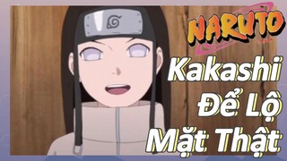 Kakashi Để Lộ Mặt Thật