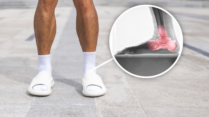 Sepatu “Kekinian” di Media Sosial Sedang Secara Rahasia Merusak Kaki Anda