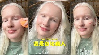 I'm an albino, so of course people are going to be mean to me.