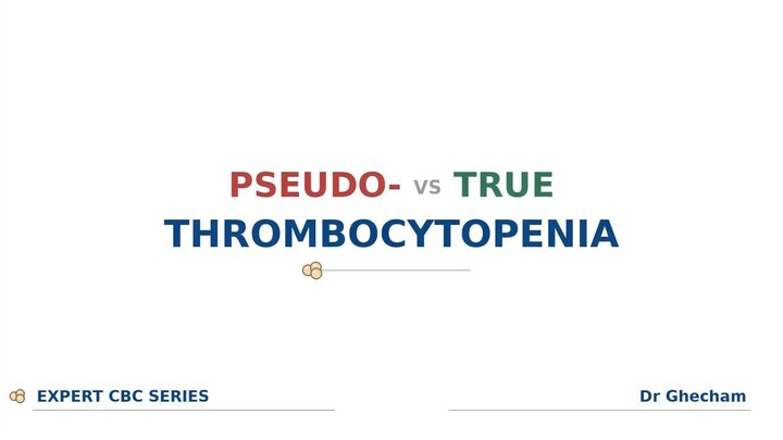 PSEUDO- VS TRUE THROMBOCYTOPENIA