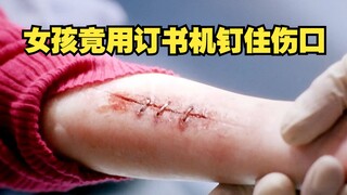 Cô gái này tàn nhẫn đến mức đã bấm ghim vào vết thương