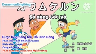 Doraemon tập 628 | Bộ móng bóc vỏ | Vietsud + Lồng tiếng