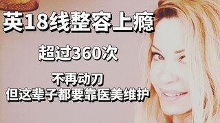 Wanita Inggris ini kecanduan operasi plastik hingga lebih dari 360 kali; bahkan setelah berhenti men