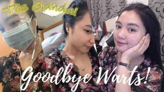 【ENG/FIL】 Warts Removal Experience Goodbye Warts in 7 days! DID IT HURT? | VLOG ♡ 1