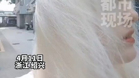 Cô gái bạch tạng chụp ảnh tự sướng dưới nắng, “Tôi thấy mình khi cười…