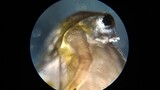 Daphnia magna, Microscopy Video part 2
