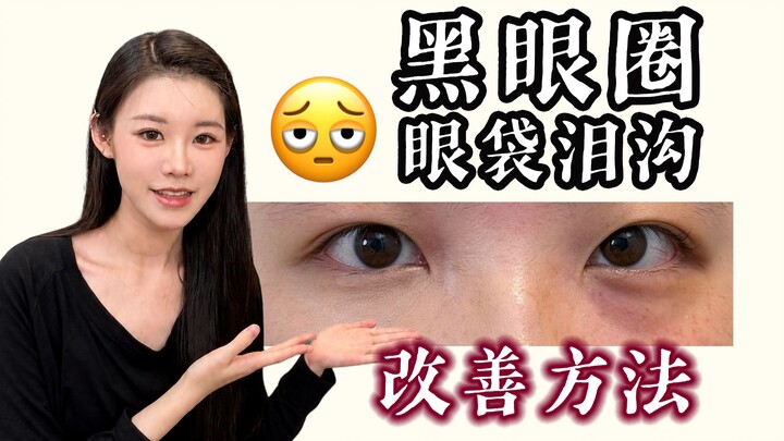 The ultimate solution for severe dark circles, eye bags, and tear troughs.
