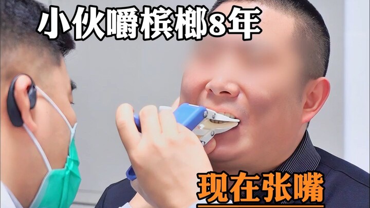 Chàng trai nhai trầu suốt 8 năm, giờ há miệng chỉ được chưa đến 1 cm; Bác sĩ Tống: “Ngón tay tôi còn