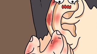 ยิ่งคันก็ยิ่งเกา! ยิ่งเกาก็ยิ่งคัน!