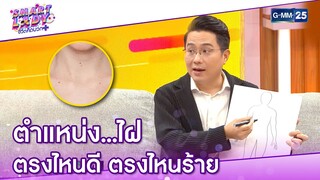 ตำแหน่ง...ไฝ ตรงไหนดี ตรงไหนร้าย l HIGHLIGHT Smart Lady ชีวิตคิดบวก 3 เม.ย. 64 l GMM25