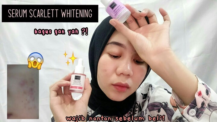 REVIEW SERUM SCARLETT (pemakaian selama 2 minggu)