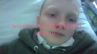 Nose bleed pt 1