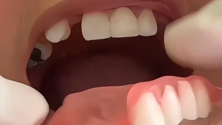 كم من نجوم لديهم أسنان جميلة لكنها في الحقيقة مزيفة!