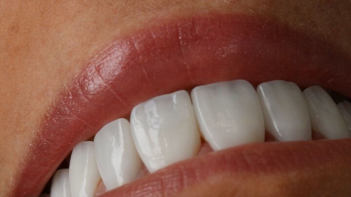 lente dental
