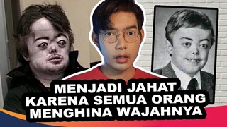 DICENG-CENGIN KARENA MUKANYA EH MALAH JADI BEGINI