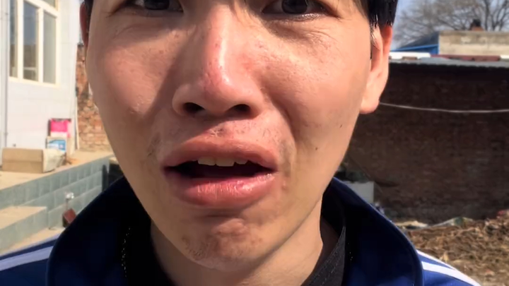 Finally, after my persuasion, my father finally stopped slapping me.